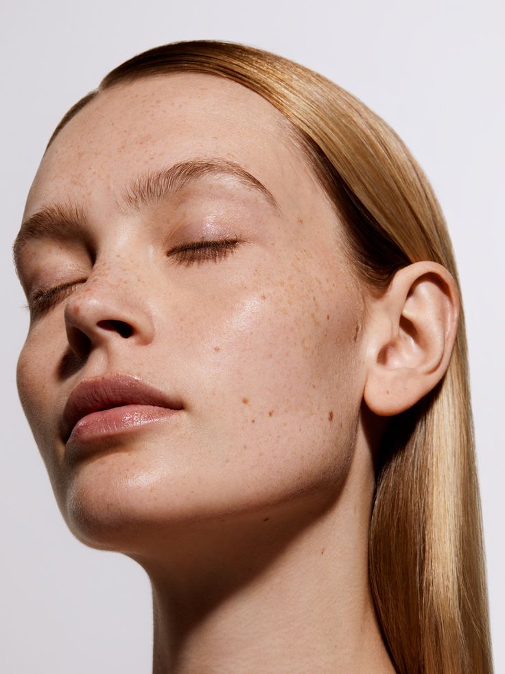 Commercial for Clinuvel — ANNA ARCHEN